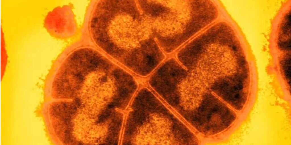 Deinococcus radiodurans