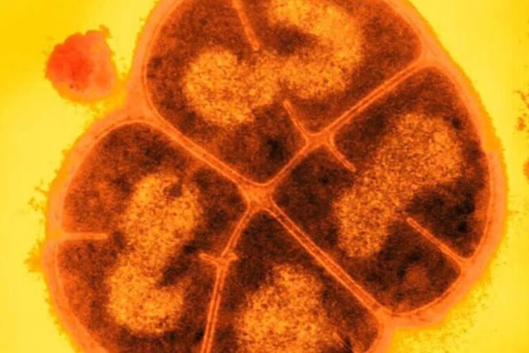 Deinococcus radiodurans