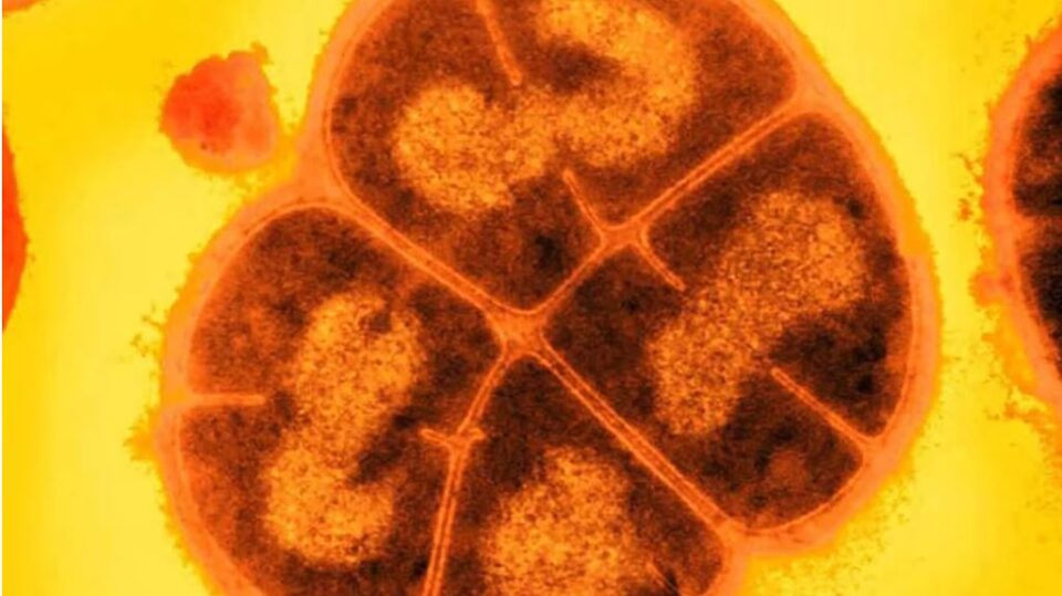 Deinococcus radiodurans